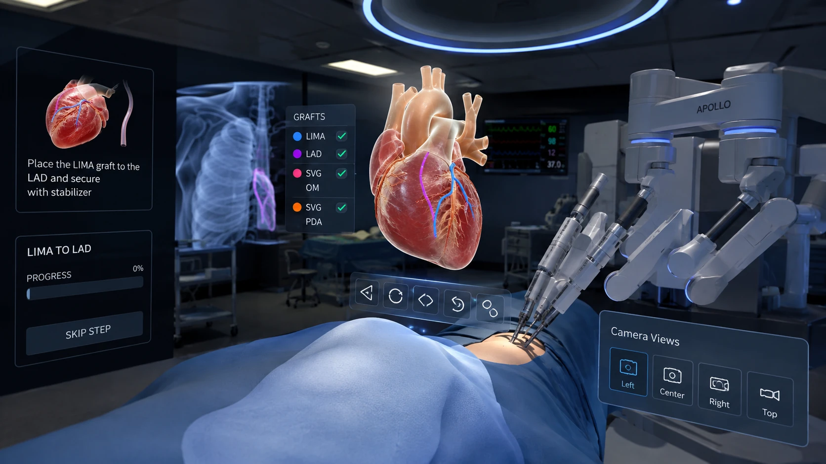 Apollo Hospitals CABG VR surgical training simulation